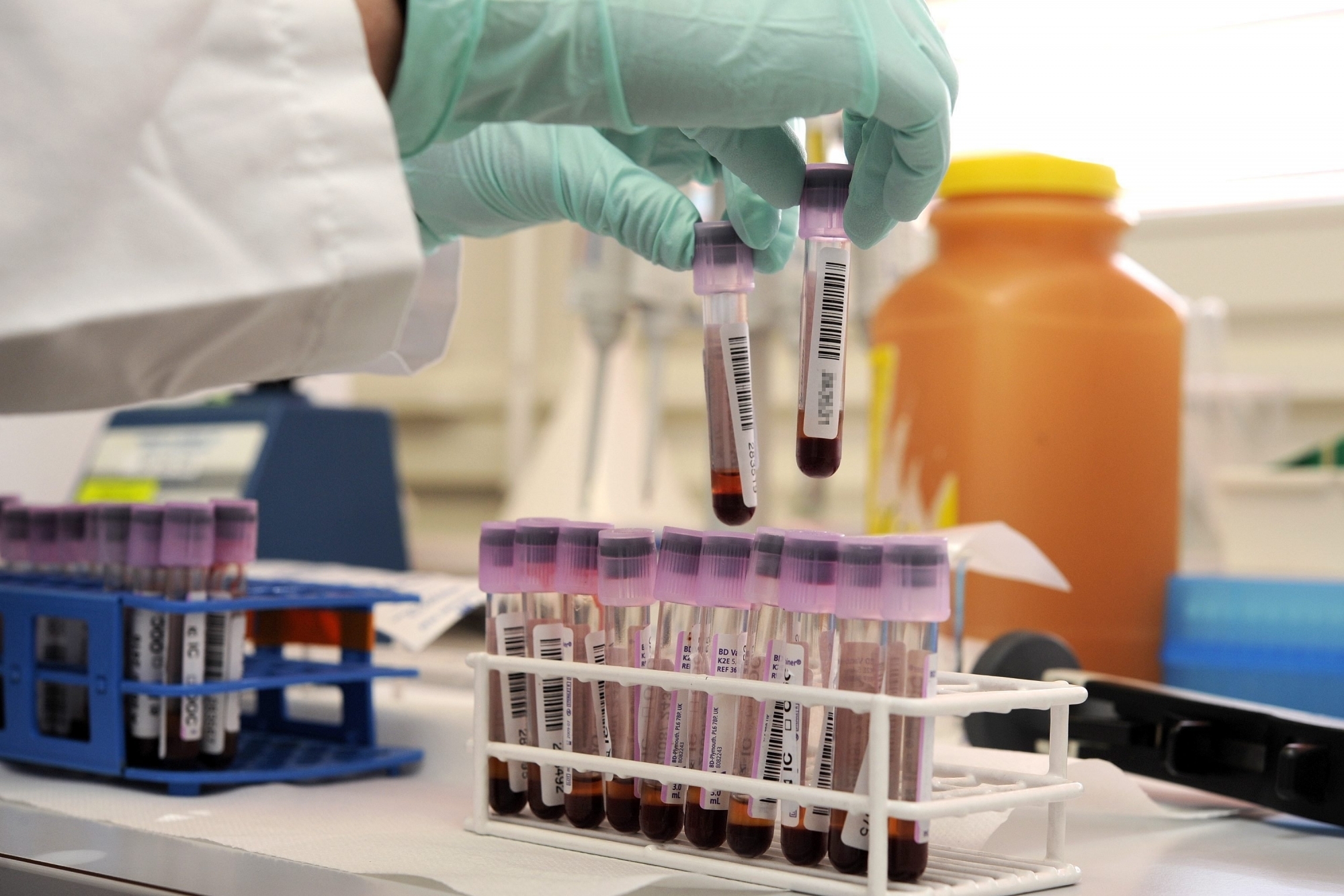 Une prise de sang peut déterminer si une personne a été contaminée par le coronavirus.