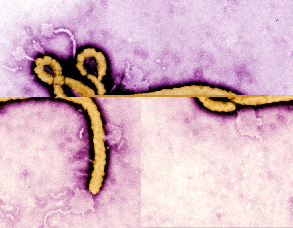 Une épidémie de virus Ebola sévit en Guinée.