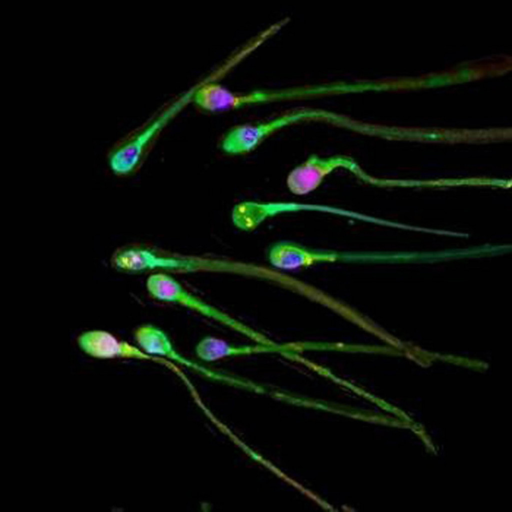 This a a handout image from The Journal of Science of human sperm which may 'sniff' their way to the egg during fertilisation, according to new research reported, Thursday March 27, 2003. If the findings are confirmed it could lead to better IVF techniques and new methods of contraception. German and US scientists discovered a smell receptor molecule on the surface of human sperm cells, similar to those in the nose. (KEYSTONE/AP Photo/PA/Journal of Science) === , UNITED KINGDOM OUT, MAGAZINES OUT ===