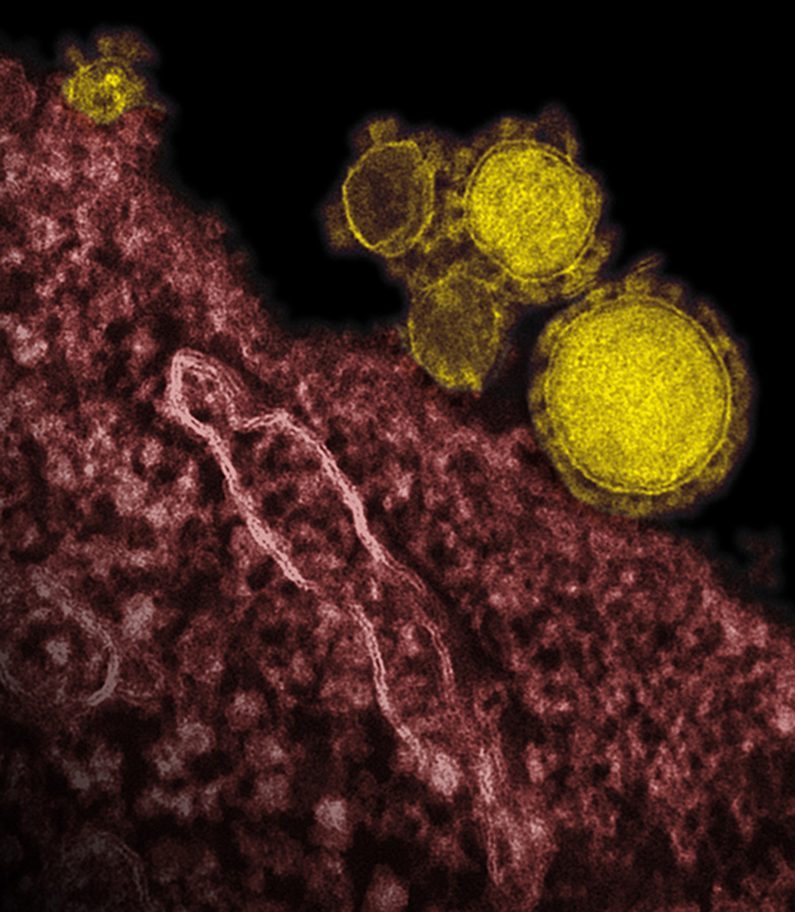 538 cas d'infection au coronavirus MERS, dont 187 décès, c'est le bilan provisoire de l'épidémie qui secoue actuellement l'Arabie saoudite.