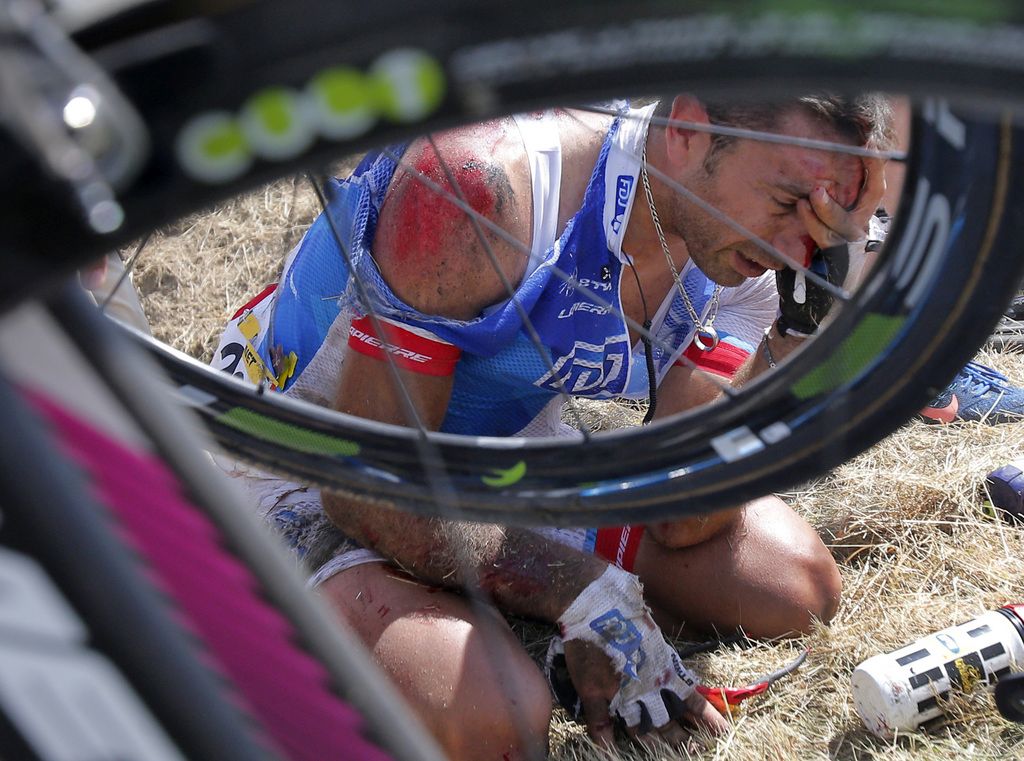 William Bonnet of France holds his head after crashing with several other riders during the third stage of the Tour de France cycling race over 159.5 kilometers (99.1 miles) with start in Antwerp and finish in Huy, Belgium, Monday, July 6, 2015. Bonnet abandoned the race following the crash. (AP Photo/Christophe Ena)