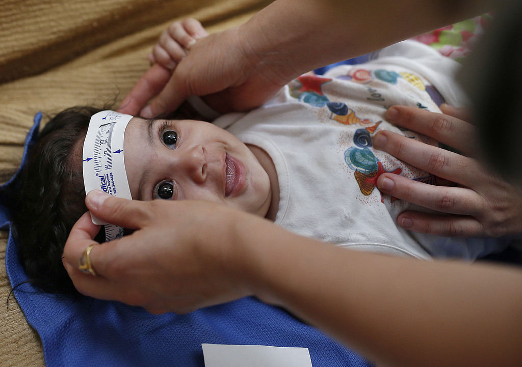 De graves anomalies du développement cérébral (microcéphalies) touchent notammentt des bébés nés de mères infectées.