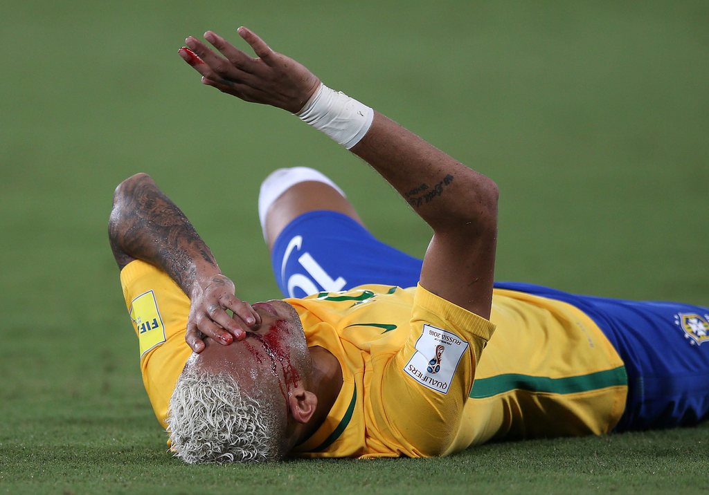 Bien qu'impressionnante, cette blessure devrait toutefois être vite oubliée pour l'attaquant brésilien. 