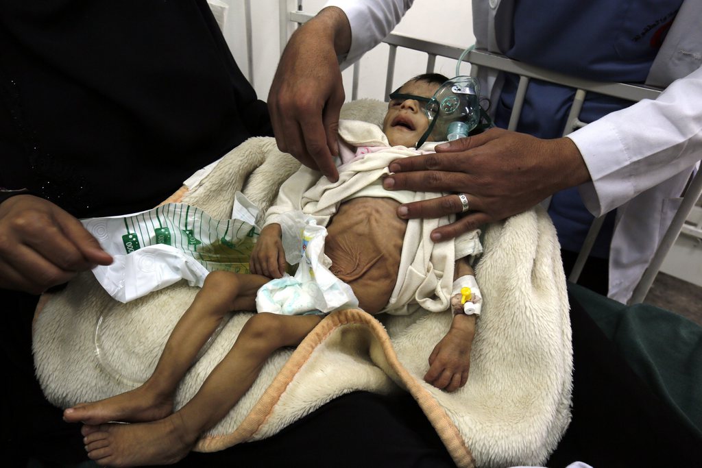 L'UNICEF est particulièrement préoccupée par la situation au Yémen où des milliers d'enfants souffrent de malnutrition.