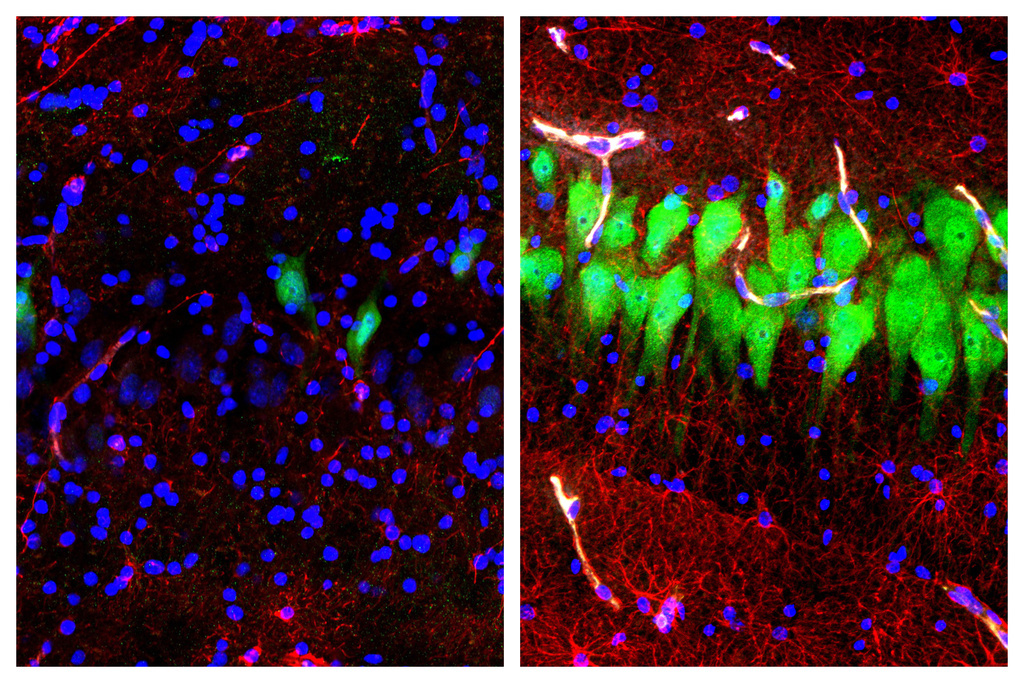 Cette combinaison d'images fournie par Yale, montre des neurone, des astrocytes et des cellules dans un cerveau de porc. A gauche, sans traitement, et à droite après traitement.