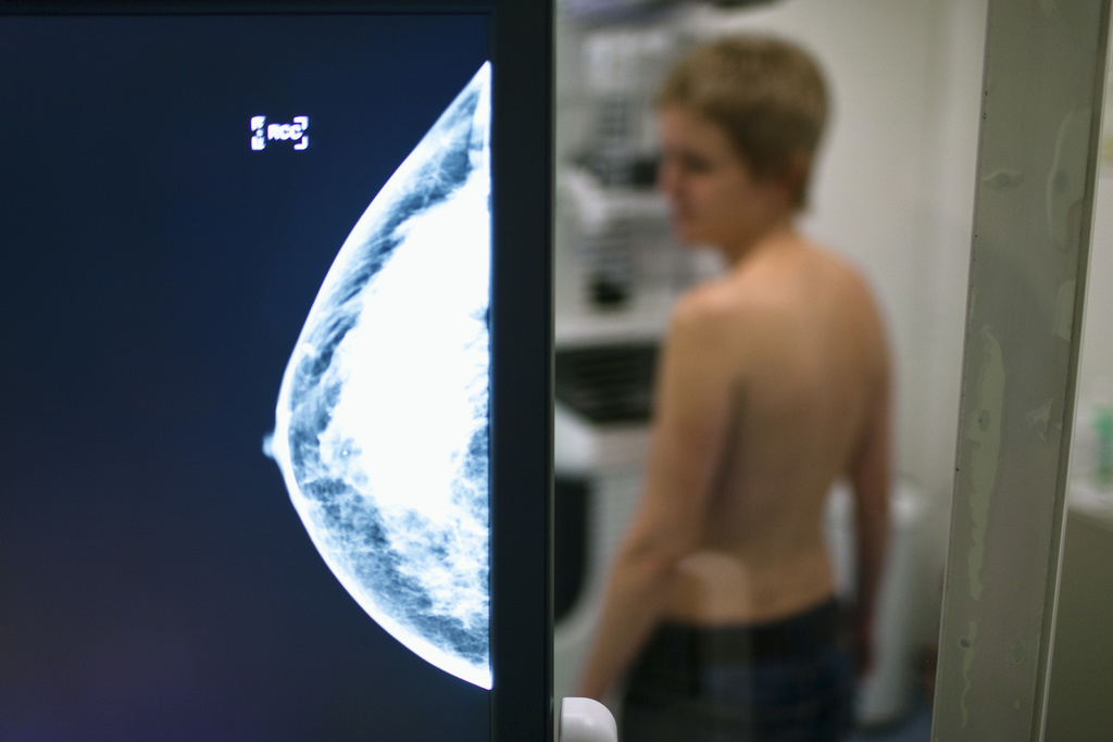 Environ 1400 femmes et dix hommes sont décédés des suites d'un cancer du sein en 2019. La mammographie est une des méthodes pour le déceler le plus tôt possible.