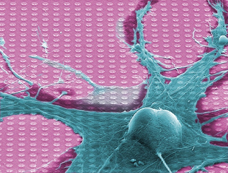 L'approche des chercheurs pourrait à l'avenir permettre de restaurer les fibres nerveuses de manière ciblée.