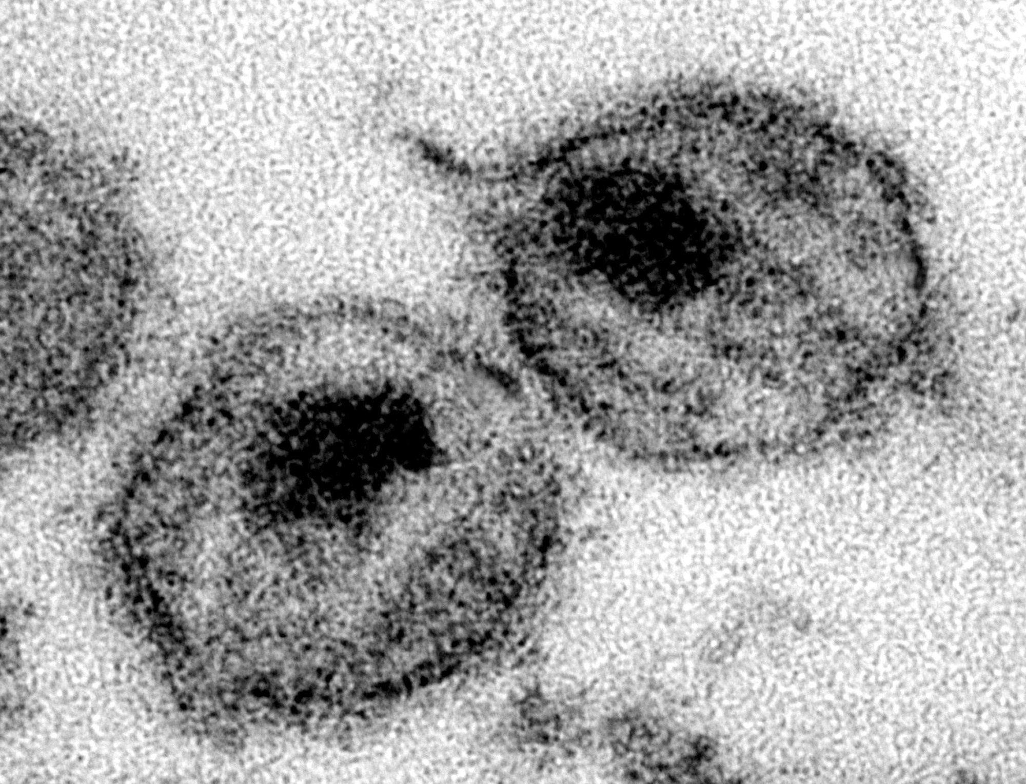 Image de virus du VIH, responsable du sida, prise au microscope électronique.